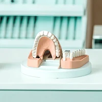 Установка виниров