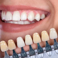 Выбор коронок